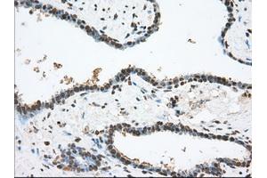 Image no. 1 for anti-Transforming, Acidic Coiled-Coil Containing Protein 3 (TACC3) antibody (ABIN1498099) (TACC3 抗体)