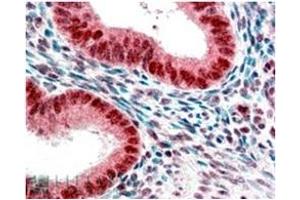 Image no. 1 for anti-Chromobox Homolog 5 (CBX5) (Internal Region) antibody (ABIN374617) (CBX5 抗体  (Internal Region))