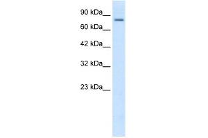 WB Suggested Anti-KCNN3 Antibody Titration:  0.