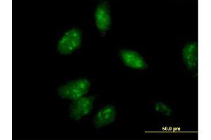 Immunofluorescence of purified MaxPab antibody to ANXA4 on HeLa cell. (Annexin IV 抗体  (AA 1-321))