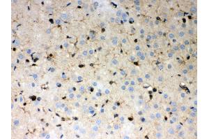 Immunohistochemistry (IHC) image for anti-Peroxiredoxin 1 (PRDX1) (AA 100-128), (Middle Region) antibody (ABIN3043903)