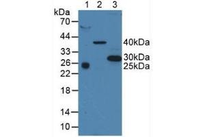 Western blot analysis of (1) Human Serum, (2) Porcine Liver Tissue and (3) Human A375 Cells. (CD63 抗体  (AA 103-203))