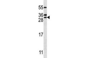 RAB5C antibody western blot analysis in Jurkat lysate. (Rab5c 抗体  (AA 178-207))