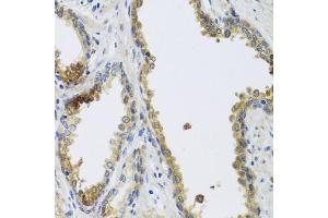 Immunohistochemistry of paraffin-embedded human prostate using GFER antibody. (GFER 抗体)