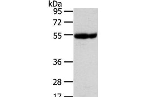Western Blot analysis of Human placenta tissue using UBAP1 Polyclonal Antibody at dilution of 1/400 (UBAP1 抗体)