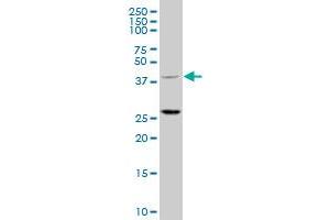 TRIM63 polyclonal antibody (A01), Lot # 051219JC01 Western Blot analysis of TRIM63 expression in HepG2 . (TRIM63 抗体  (AA 254-352))
