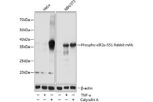 Western blot analysis of extracts of various cell lines, using Phospho-eIF2α-S51 Rabbit mAb (ABIN6135266, ABIN6136152, ABIN6136153 and ABIN7101882) at 1:1000 dilution. (EIF2S1 抗体  (pSer51))