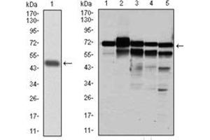 Western Blotting (WB) image for anti-Replication Protein A1, 70kDa (RPA1) antibody (ABIN1108896) (RPA1 抗体)