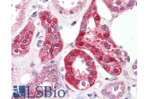 ABIN940551 (5µg/ml) staining of paraffin embedded Human Kidney. (SLC6A8 抗体  (Internal Region))
