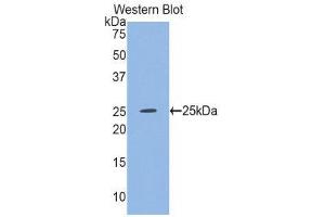 Western Blotting (WB) image for anti-Glutathione Synthetase (GSS) (AA 268-474) antibody (ABIN1859084) (Glutathione Synthetase 抗体  (AA 268-474))