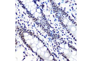 Immunohistochemistry (IHC) image for anti-Nuclear Factor of kappa Light Polypeptide Gene Enhancer in B-Cells Inhibitor, alpha (NFKBIA) (pSer36) antibody (ABIN7268992)