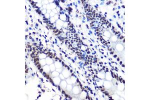 Immunohistochemistry of paraffin-embedded human colon using Phospho-IκBα-S36 Rabbit mAb (ABIN7268992) at dilution of 1:100 (40x lens). (NFKBIA 抗体  (pSer36))