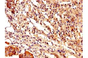 Immunohistochemistry (IHC) image for anti-Calpastatin (CAST) (AA 1-667) antibody (ABIN7146551)