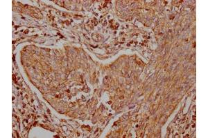 Immunohistochemistry (IHC) image for anti-TNF Receptor-Associated Factor 2 (TRAF2) antibody (ABIN7127853)