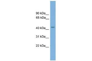 TSPYL6 antibody used at 1 ug/ml to detect target protein. (TSPY-Like 6 抗体  (N-Term))