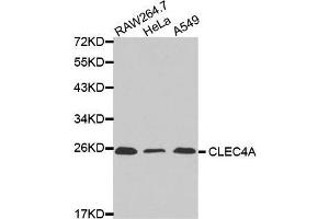 Western blot analysis of extracts of various cell lines, using CLEC4A antibody. (CLEC4A 抗体  (AA 70-237))