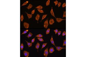 Immunofluorescence analysis of L929 cells using Thioredoxin reductase 2 (TXNRD2 ) antibody (ABIN6128856, ABIN6149741, ABIN6149742 and ABIN6221158) at dilution of 1:100. (TXNRD2 抗体  (AA 100-310))