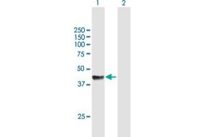 Western Blot analysis of RAD51C expression in transfected 293T cell line by RAD51C MaxPab polyclonal antibody.
