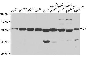 Western blot analysis of extracts of various cell lines, using GPI antibody. (GPI 抗体)