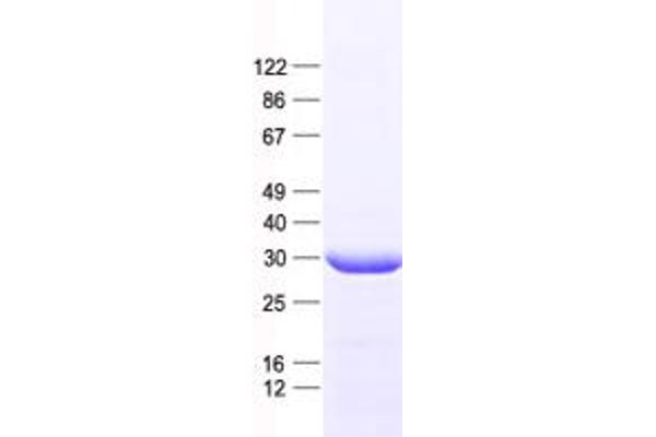 Histone H3.3 Protein (His tag)
