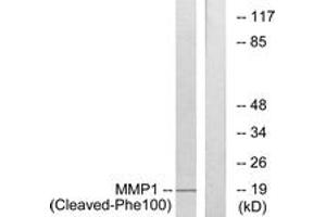 Western Blotting (WB) image for anti-Matrix Metallopeptidase 1 (Interstitial Collagenase) (MMP1) (AA 81-130), (Cleaved-Phe100) antibody (ABIN2891204) (MMP1 抗体  (Cleaved-Phe100))