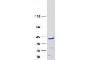Validation with Western Blot
