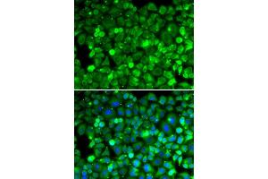 Immunofluorescence analysis of HeLa cell using RPLP1 antibody. (RPLP1 抗体)