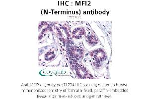Image no. 1 for anti-Antigen P97 (Melanoma Associated) Identified By Monoclonal Antibodies 133.2 and 96.5 (MFI2) (N-Term) antibody (ABIN1736928) (MFI2 抗体  (N-Term))