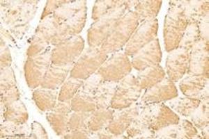 Immunohistochemistry analysis of paraffin-embedded rat skeletal muscle using,KPB1+2 (ABIN7074443) at dilution of 1: 3000 (KPB1/2 抗体)
