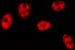 ABIN6274464 staining HeLa cells by IF/ICC. (BRF1 抗体  (Internal Region))