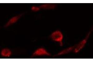 ABIN6278331 staining  A431 cells by IF/ICC. (PLCB3 抗体  (C-Term))