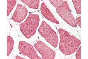 Human Skeletal Muscle: Formalin-Fixed, Paraffin-Embedded (FFPE). (NRF1 抗体  (N-Term))