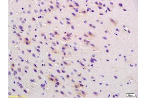 Formalin-fixed and paraffin embedded rat brain labeled with Anti Phospho-Cofilin (Ser3) Polyclonal Antibody , Unconjugated at 1:200, followed by conjugation to the secondary antibody and DAB staining (Cofilin 抗体  (pSer3))