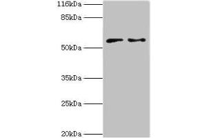 Western blot All lanes: CRISPLD2 antibody at 2 μg/mL Lane 1: Jurkat whole cell lysate Lane 2: CEM whole cell lysate Secondary Goat polyclonal to rabbit IgG at 1/10000 dilution Predicted band size: 56, 52, 43, 18, 14 kDa Observed band size: 56 kDa