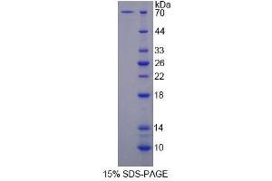 SDS-PAGE (SDS) image for Surfeit 1 (SURF1) (AA 1-306) protein (His tag,GST tag) (ABIN6239480) (SURF1 Protein (AA 1-306) (His tag,GST tag))