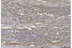 IHC analysis of ANXA4 using anti-ANXA4 antibody (ABIN5518805).