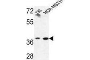 Western Blotting (WB) image for anti-Methionine Adenosyltransferase II, beta (MAT2B) antibody (ABIN3004219) (MAT2B 抗体)