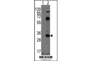 Western blot analysis of CD8A using rabbit polyclonal CD8A Antibody using 293 cell lysates (2 ug/lane) either nontransfected (Lane 1) or transiently transfected with the CD8A gene (Lane 2). (CD8 alpha 抗体  (C-Term))