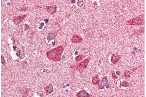 Human Brain, Cortex (formalin-fixed, paraffin-embedded) stained with PITPNM3 antibody ABIN337021 at 5 ug/ml followed by biotinylated anti-goat IgG secondary antibody ABIN481715, alkaline phosphatase-streptavidin and chromogen. (NIR1 抗体  (AA 962-974))