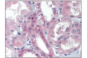 Immunohistochemistry (IHC) image for anti-BRCA1/BRCA2-Containing Complex, Subunit 3 (BRCC3) (AA 1-316), (N-Term) antibody (ABIN400864) (BRCC3 抗体  (N-Term))