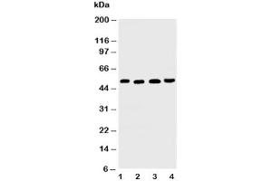 Western blot testing of TRAIL R2 antibody and Lane 1:  HeLa