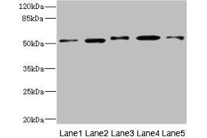 Western blot All lanes: NFKBIE antibody at 4. (NFKBIE 抗体  (AA 140-280))