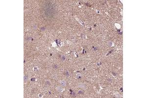 ABIN6266852 at 1/100 staining human brain tissue sections by IHC-P. (APC 抗体  (Internal Region))