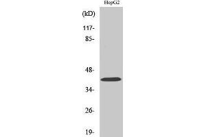 Western Blotting (WB) image for anti-Ribosomal Modification Protein RimK-Like Family Member B (RIMKLB) (Internal Region) antibody (ABIN3175055) (RIMKLB 抗体  (Internal Region))