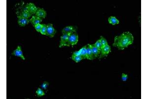 Immunofluorescent analysis of HepG2 cells using ABIN7173992 at dilution of 1:100 and Alexa Fluor 488-congugated AffiniPure Goat Anti-Rabbit IgG(H+L) (Tat (AA 25-111) 抗体)