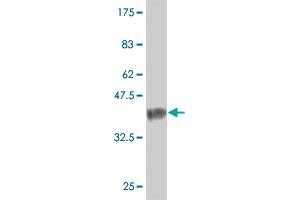 Western Blot detection against Immunogen (37. (NXNL1 抗体  (AA 81-190))