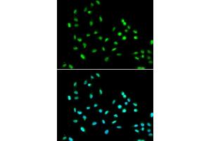 Immunofluorescence analysis of  cells using SM antibody (ABIN6131360, ABIN6148103, ABIN6148105 and ABIN6221551). (SMARCAD1 抗体  (AA 1-300))