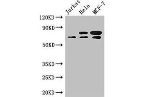 Western Blot Positive WB detected in: Jurkat whole cell lysate, Hela whole cell lysate, MCF-7 whole cell lysate All lanes: INTS9 antibody at 3. (INTS9 抗体  (AA 368-658))