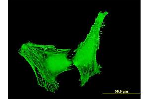 Immunofluorescence (IF) image for anti-ARP1 Actin-Related Protein 1 Homolog B, Centractin beta (ACTR1B) (AA 191-286) antibody (ABIN564380)