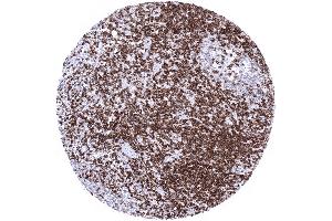 Tonsil Strong CD5 positivity of T lymphocytes interfollicular and in germinal centres (Recombinant CD5 抗体  (AA 32-372))